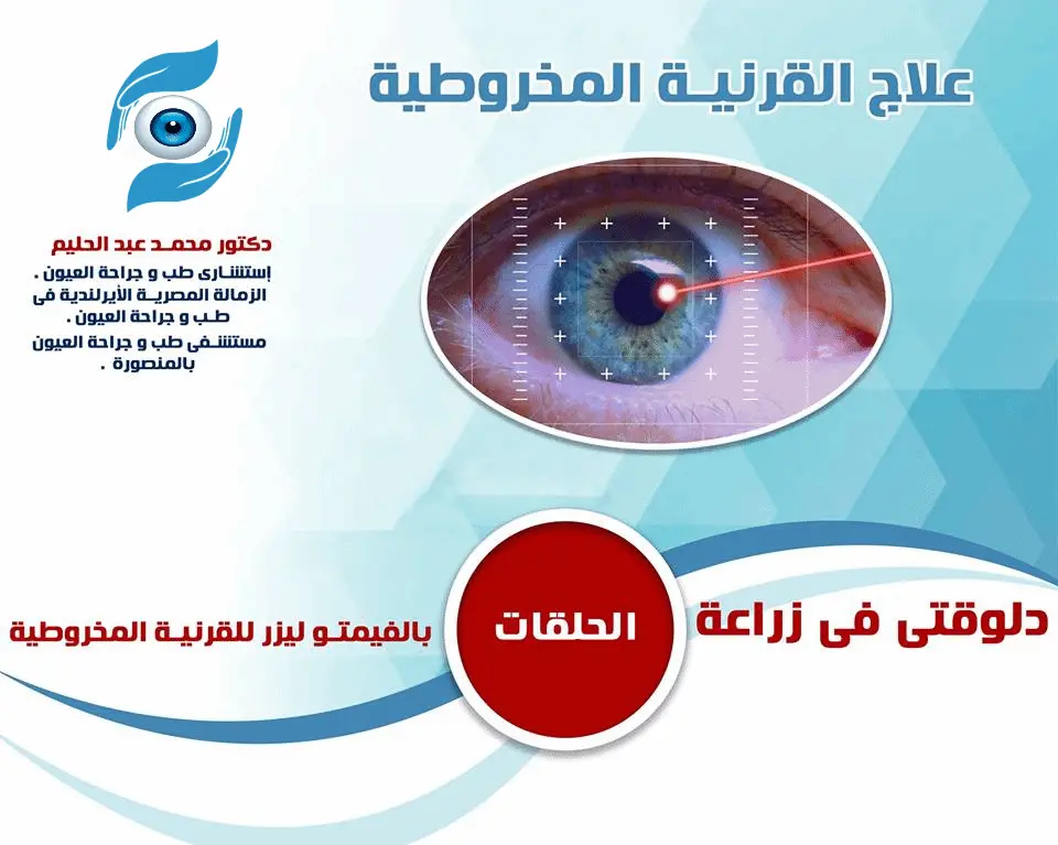 عملية زراعة القرنية في مركز دكتور محمد عبد الحليم 